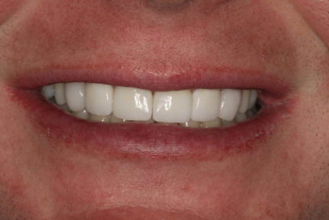 Difference cosmetic dentistry makes