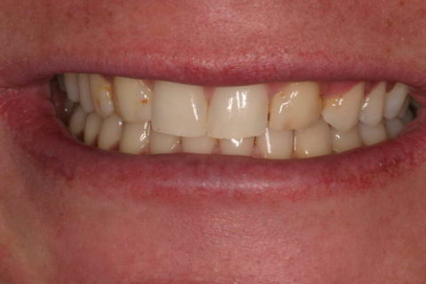 Difference cosmetic dentistry makes