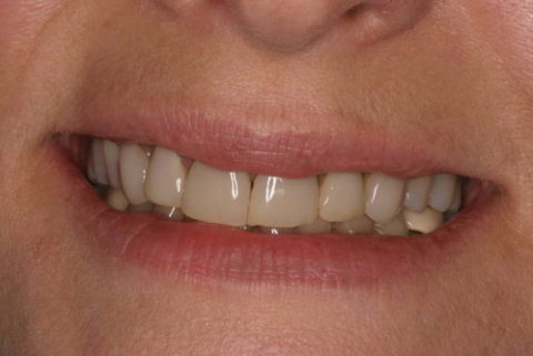 Photos of before and after cosmetic treatment