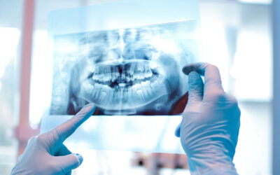 Why do I need a dental X-ray?