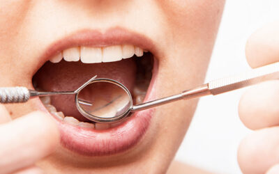 The Benefits of Periodontal Deep Cleaning