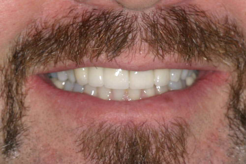 After
