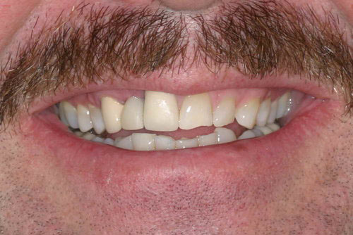 Before